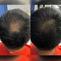 محصولی از آلمان برای جذاب تر شدن تو