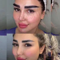 میکرو کاشت ابرو با 50٪ تخفیف ویژه جشنواره