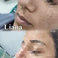 فیشیال (پاکسازی پوست)