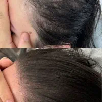 نتیجه‌ی واقعی درمانجو‌ها