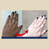 سفید کننده آنی   بعد از استفاده  همون لحظه سفید شو