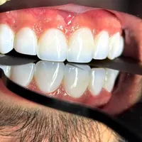 دندانپزشکی ماه دنتال|خدمات آرایشگری و زیبایی|تهران, نارمک جنوبی|دیوار