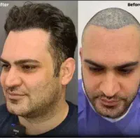 کلینیک زیبایی کاشت مو وابرو ،بلفاروخدمات دندان