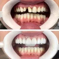 دندانپزشکی اقساطی بلند مدت
