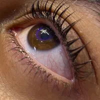 لیفت مژه و ابرو