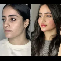 فیلر۷۹۰ژل۷۹۰جوانساز آنزیم مزو صورت مو بوتاکس پزشک