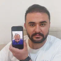 کاشت مو و ابرو به صورت تخصصی در تبریز و تمام قسط