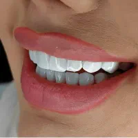 دندانپزشکی، ۵۰٪تخفیف تمامی خدمات و اقساط بلند مدت