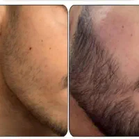 مرد این شکلیه