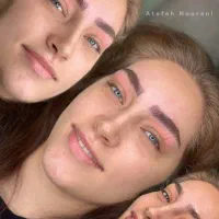 فیبروز ابرو