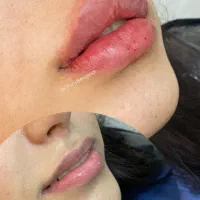 زیبایی پوست و مو
