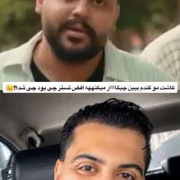 *کاشت مو و ابرو فقط مبلغ *۲۰*میلیون آفر خیلی ویژه*