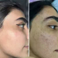 کرم 8کاره ضد لک لاکچری کوین قوی ترین ضد لک فرانسوی