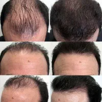 وقتشه دوباره به موهای پرپشتت سلام کنی