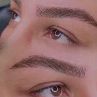 اف میکروبلیدینگ و شیدینگ لب تتو صورت