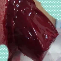 حجامت\زالو درمانی\طب سنتی(آقا و خانم)