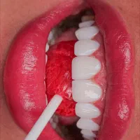 کامپوزیت با شرایط ویژه