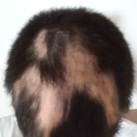 شونه میشکنه تو موهات
