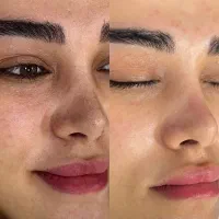 فیشال تخصصی و اسکالپ تراپی . جم