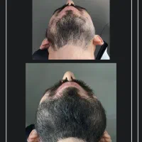۲۵ سالته ولی انگار بچه ای