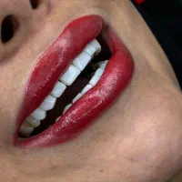 کامپوزیت ونیر صدفی هر فک ۵/۹۸۰
