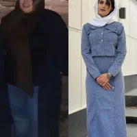 لاغری با بوتاکس معده  /کلینیک مهرزاد