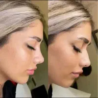 جراحی زیبایی بینی فقط با۲۹میلیون کلینیک تخصصی