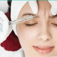 تزریق بوتاکس و فیلر(ژل)توسط پزشک