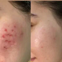 خدمات تخصصی پوست گلداسکین و لیزر موهای زائد