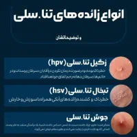 زگیل تناسلی hpv