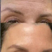 بیوممتیک اورجینال شارژ شد