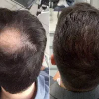 افسرده میشی اگه همینجوری پیش‌بره