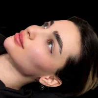 تخفیف ویژه بوتاکس و ژل رزرو محدود این هفته