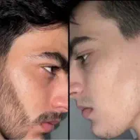 فرصت مناسب برای رویش ریش و سیبیل