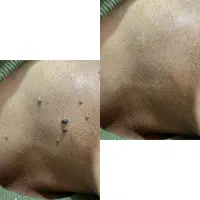 زیبایی پوست اتفاقی نیست،نتیجه انتخاب درست است