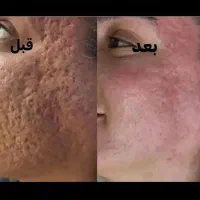 آموزش با ارائه مدرک فنی حرفه ای