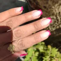 کاشت با قیمت مناسب
