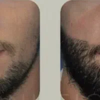 ابهت خاصی با ریش داری