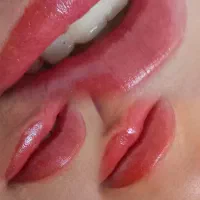 شید لب و رفع کبودی صدرا، فاز ۱، بلوار زاگرس