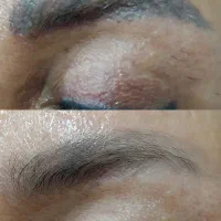 ریموو تتو و آرایش دائم صورت