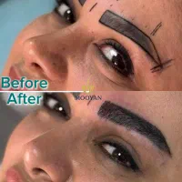 جشنواره‌کاشت‌مو(VIP)۲۴تومن کاشت ابرو۱۴‌(اقساطی)