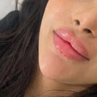 ژل لب بوتاکس پی ار پی چالگون فول فیس آموزش 4میلیون