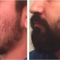 این آخرین اقدامه