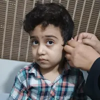 حجامت، زالودرمانی، سم‌زدایی از پا، بادکش|خدمات آرایشگری و زیبایی|تهران, مسعودیه|دیوار