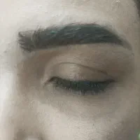 ریموو تاتو تک جلسه ای با متریال اورجینال رجووی