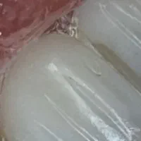 کرجی ها مژده کامپوزیت انجام بده بدون پرداخت