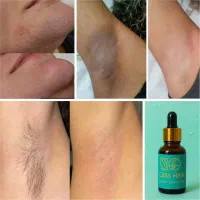 رفع دائم موهای بدون لیزر (پرداخت درب منزل)