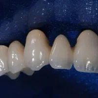 لابراتوار دندانسازی رویال