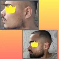 برای پرپشتی ریش سبیل /قبل خرید مشاوره رایگان