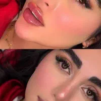 جشنواره تزریق فیلربادی و ژل و بوتاکس در کلینیک